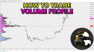 How to Trade Volume Profile VPVR VWAP  and VPSR Analysis Stocks Crypto Forex [upl. by Publias]