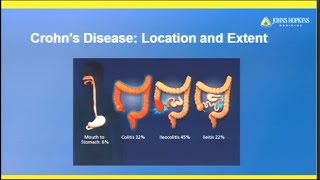 How to read a CT  Approach to Running Bowel [upl. by Anselmo]