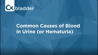 What Causes Blood in Urine  Cxbladder [upl. by Cirted131]